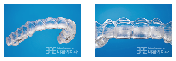 투명교정사진 